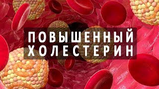 10 признаков | ХОЛЕСТЕРИНА | повышенного 10 признаков | ХОЛЕСТЕРИНА | повышенного