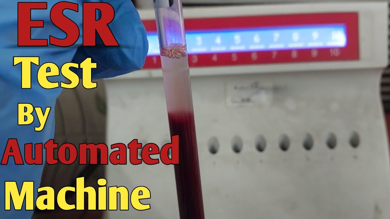 ESR Test Procedure ESR Test In Automated Machine ESR Increase ESR Test Procedure ESR Test In Automated Machine ESR Increase
