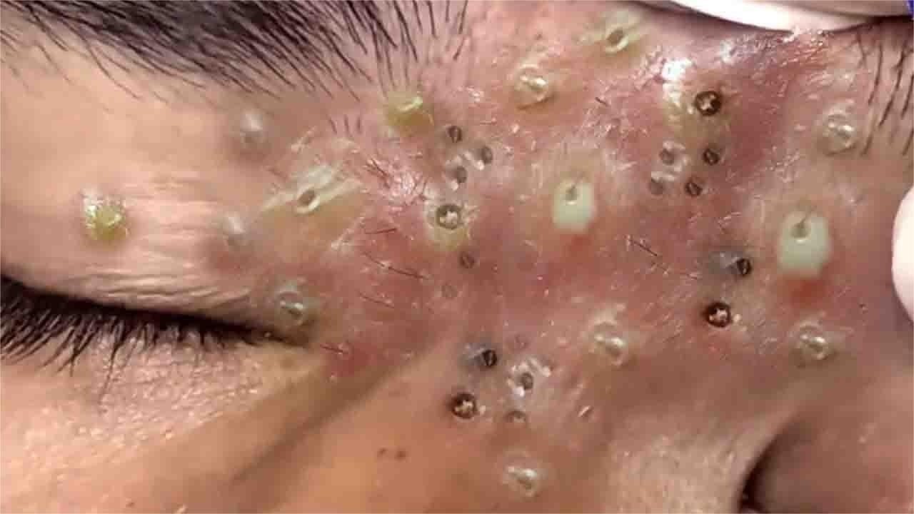 𝑺𝒐𝒐𝒕𝒉𝒊𝒏𝒈 𝑭𝒂𝒄𝒊𝒂𝒍 𝑻𝒓𝒆𝒂𝒕𝒎𝒆𝒏𝒕 𝑭𝒐𝒓 𝑺𝒕𝒓𝒆𝒔𝒔 𝑹𝒆𝒍𝒊𝒆𝒇 𝒂𝒕 𝑳𝒖𝒙𝒖𝒓𝒚 𝑺𝒑𝒂 𝑨𝒄𝒉𝒊𝒆𝒗𝒆 𝑰𝒏𝒏𝒆𝒓 𝑷𝒆𝒂𝒄𝒆 #500956