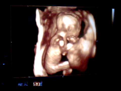 4 months old baby in womb