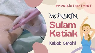 Sulam Ketiak By Monskin Auto Glowing