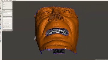 Blue Sky Plan airway segmentation