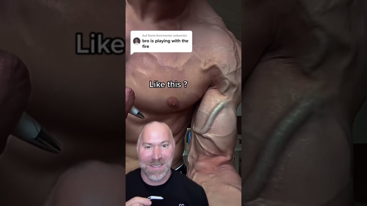 Largest Arm Veins Ever Shorts