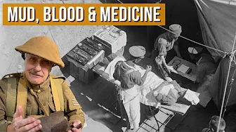 Frontline Surgeons Saving Lives in World War One