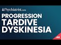 Tardive Dyskinesia: Progression