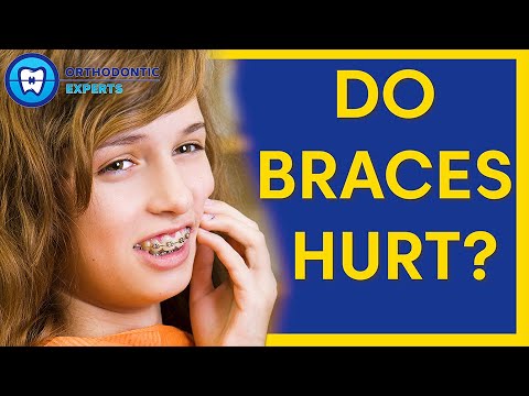 Video: Gjør tannregulering vondt?