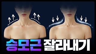 두툼한 승모근 싹뚝 잘라내기 (feat. 제니어깨)