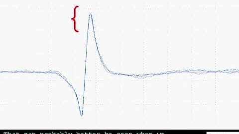SFEMG - Volitional EDC  (Erik Stalberg)