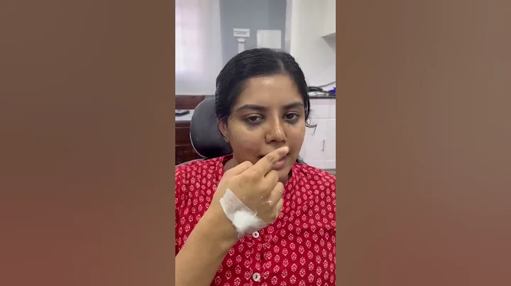 Rhinoplasty 7th day after Surgery- Patient feedback