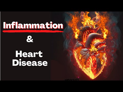 Is Inflammation the "real cause" of Heart Disease? Prof. Kausik Ray