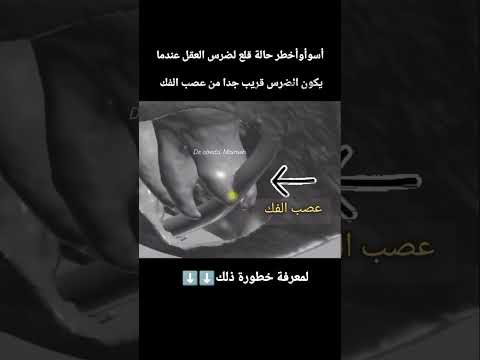 تسبب شلل بعصب الوجه أحيانا ممكن ان يكون دائم أو مؤقت وألم والتهاب شديد طبيبة اسنان قلع التهاب لايك 