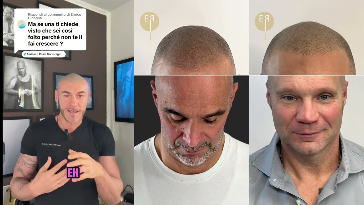 Ma perche' non te li fai crescere?L' effetto realistico della Tricopigmentazione