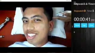 Caloric Testing - Nystagmus