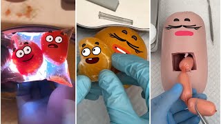 3 I Tried Food Surgery for 30 Days Here's What Happened - YouTube