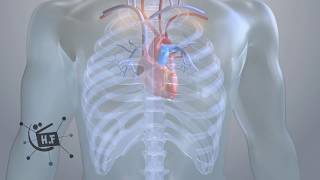 Surgical Aortic Valve Replacement medical animation product