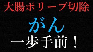悲報 大腸ガン一歩手前で手術‼️ 救えるのはあなた！