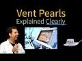 Ventilator Pearls Explained Clearly