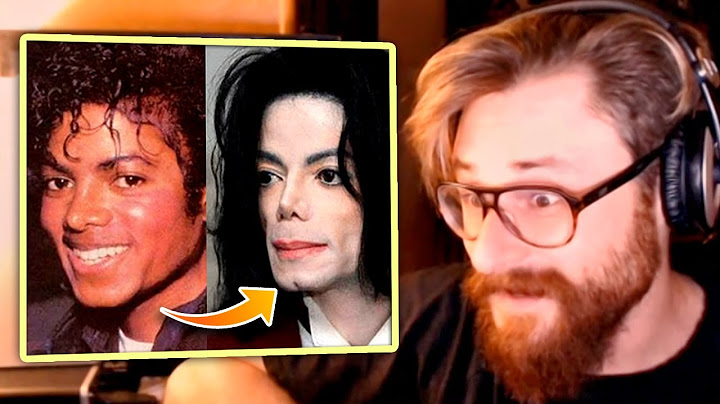 ¿Se operó Michael Jackson para cambiar el color de su piel? Experto en el cantante lo explica