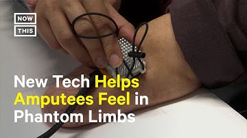 Technology Helps Amputees Feel Sensations in Phantom Limbs