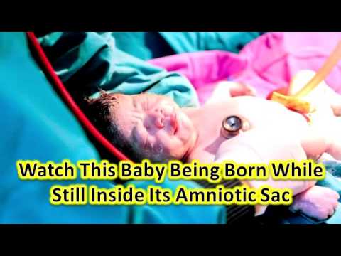 How can you watch a baby being born?