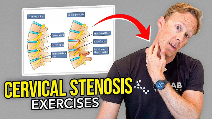 5 Exercises for Cervical Stenosis (Arm Nerve Pain)