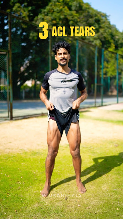 3 ACL Tears | ACL Injury #aclinjury #acltear #aclrecovery