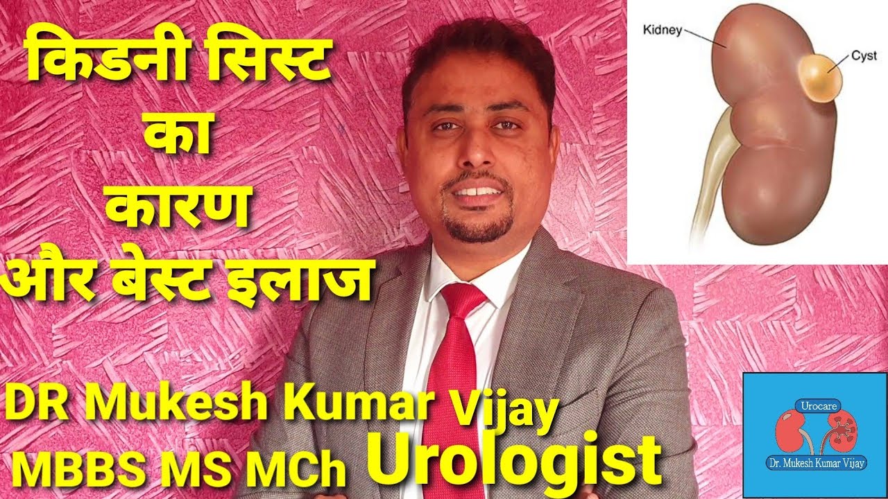 Kidney Cyst In Hindi Kidney Cyst Treatment Cyst In Kidney Kidney Kidney cyst in hindi kidney cyst treatment cyst in kidney kidney
