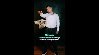 Почему появляются отеки после операции?