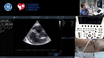4D tutorials: 6. How to acquire 4D tricuspid valve views