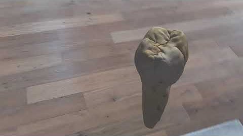 Dental Hololens 2 Demo