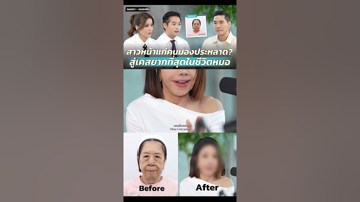 สาวหน้าแก่ เปิดหน้าครั้งแรก! โดนบูลลี่มาตลอดชีวิต คนอื่นมองเป็นตัวประหลาด? #WoodyInterview #ยุพา