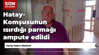 Hatay - Komşusunun Isırdığı Parmağı Ampute Edildi
