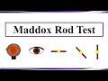 Maddox Rod Test