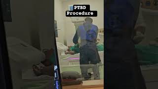 PTBD Procedure on FLUOROSCOPY #radiografer #fluoroscopy #biliarysurgery #radiologiest #ptbt #shorts