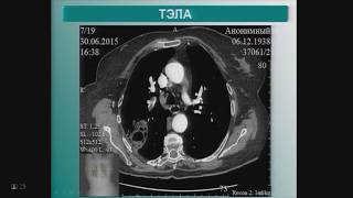 Стандарты КТ диагностики в онкологии