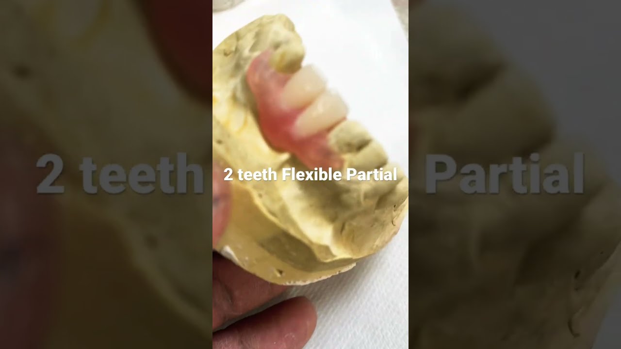 Flexible Partial A Are One Of The Best Way To Feel Confident And Smile Again