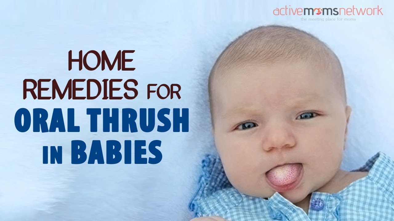 Home Remedies For Oral Thrush In Babies - YouTube
