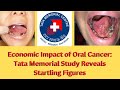 Economic impact of oral cancer tata memorial study reveals startling figures