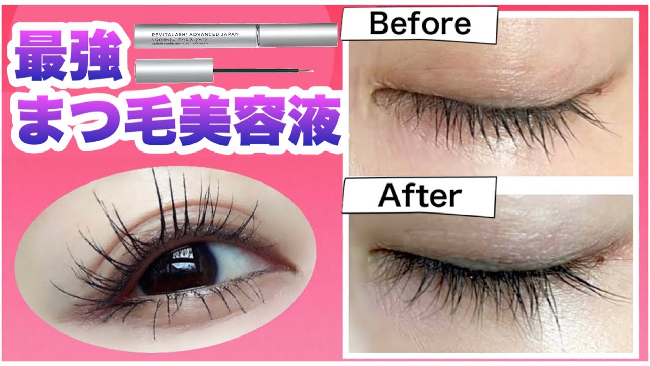 化学療法後、髪の毛が生えてくるまでどのくらい時間がかかりますか?