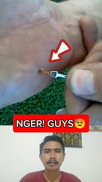 PUTTING OUT PALM TORN INSIDE THE MEAT #fyp #shorts #feedshorts #trending #popular #trendingshorts