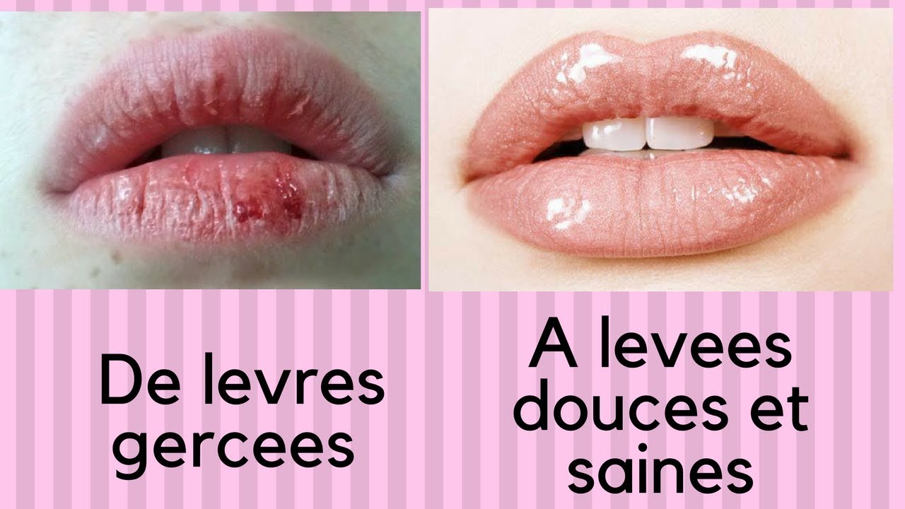 Passez de levres gercees a lèvres douces et soyeuses en quelques jours