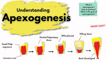 Apexogenesis | What is it? | Endodontics