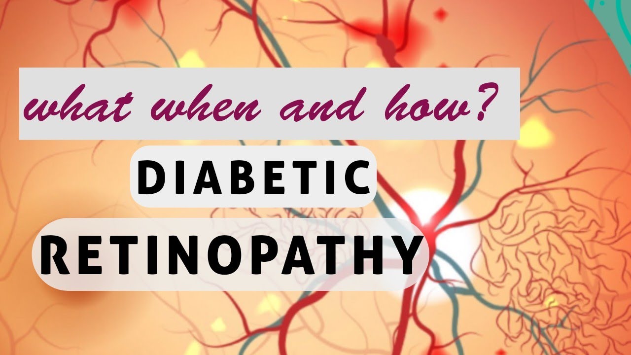 This will  change your perspective about DIABETIC RETINOPATHY!