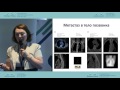 Роль радиойодтерапии в лечении рака щитовидной железы