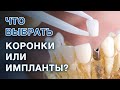 Коронки или имплант: что лучше выбрать? / Если зуб разрушен, удалять и ставить имплант или коронку?