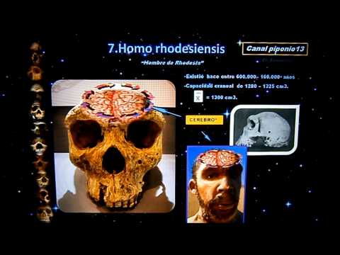 Vídeo: El Misterio De Un Cráneo Boscópico Con Un Gran Volumen Cerebral - Vista Alternativa