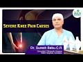 Severe Knee Pain Causes and Treatment | Knee Pain | Dr C R Suresh Babu