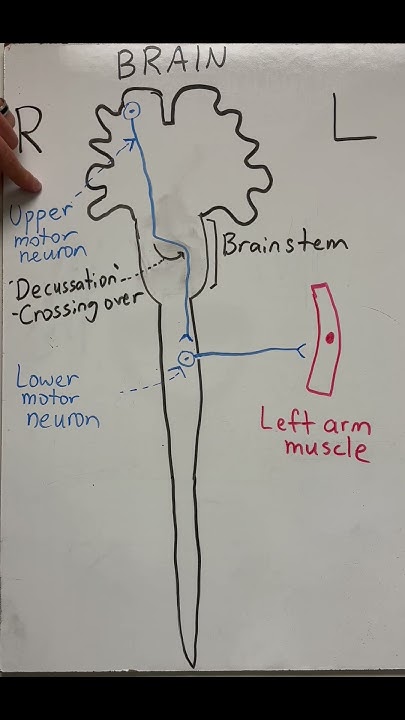why-does-the-left-side-of-your-brain-control-the-right-side-of-your