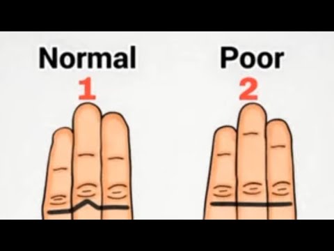 😵‍💫🧠 WHAT IS YOUR STATUS 🧠😵‍💫