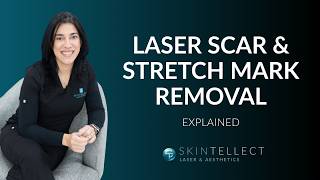 Can Lasers Remove Scars & Stretch Marks? | Best Treatment for Scars & Stretch Marks | Tampa, FL
